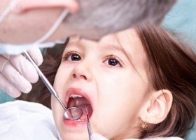 Quy trình thực hiện vệ sinh răng cho bé