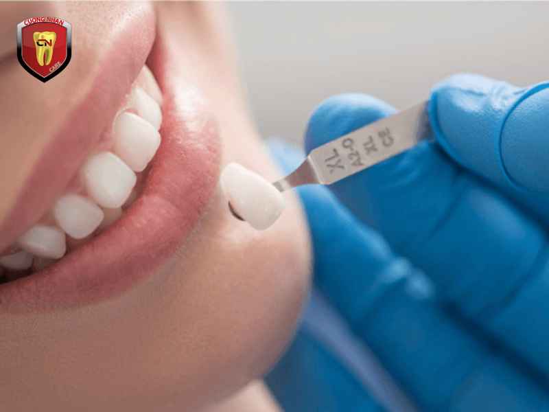 Phục hình răng sứ là gì?