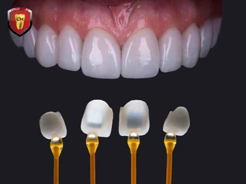 Khi nào nên phục hình răng sứ?