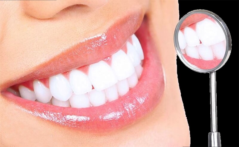 Các yếu tố nào ảnh hưởng đến chi phí tẩy trắng răng?