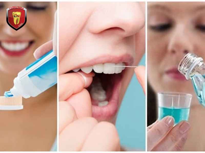 Chăm sóc răng miệng đúng cách sau khi trám răng