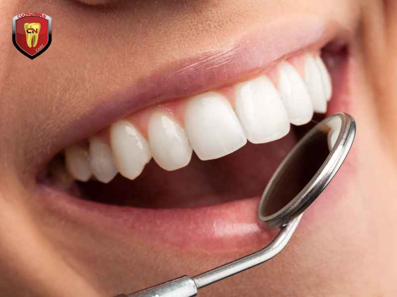 Nha khoa Cường Nhân - đơn vị trám răng uy tín tại Bình Dương
