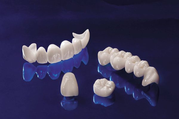 Răng sứ Cercon HT là phiên bản nâng cấp của loại răng Cercon