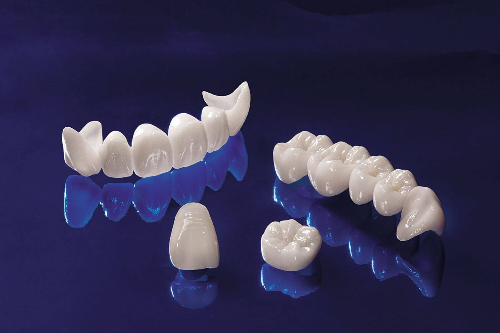 Răng sứ Cercon HT là gì? Bảng báo giá răng sứ Cercon HT