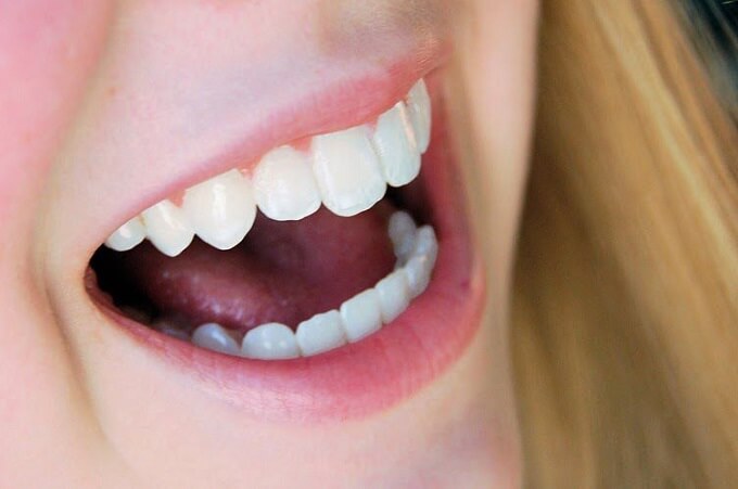 Phương pháp Cercon HT mang đến một hàm răng sáng đẹp, rạng ngời