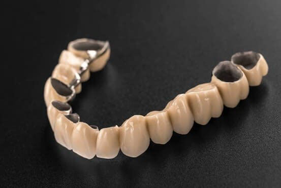 Giá trồng răng sứ Titan còn tùy thuộc vào tình trạng răng