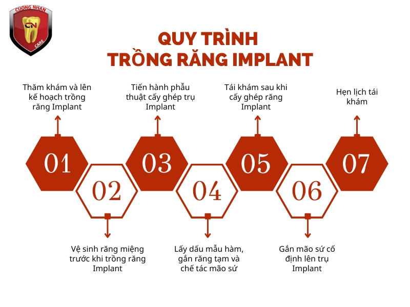 Quy trình trồng răng tại nha khoa Cường Nhân 