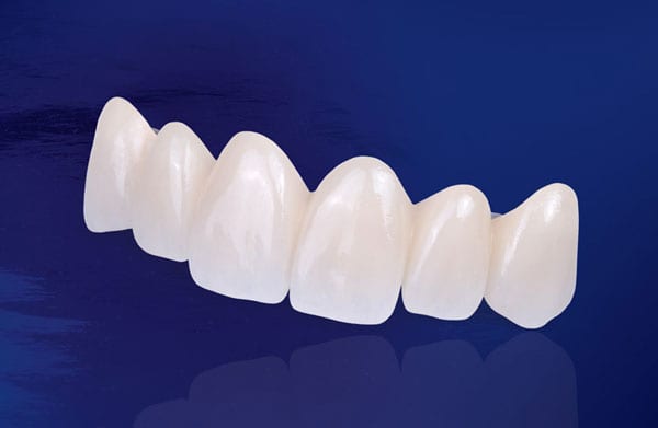 Răng sứ Zirconia có nhiều ưu điểm vượt trội
