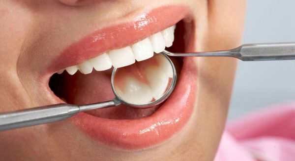 Khám tổng quát răng chính là bước không thể thiếu trong quy trình