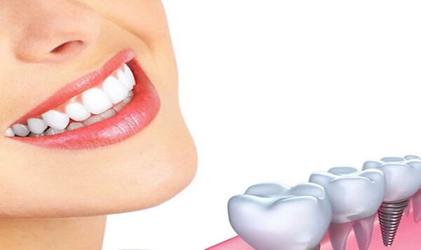 Điều trị vấn đề răng miệng theo yêu cầu của bác sĩ