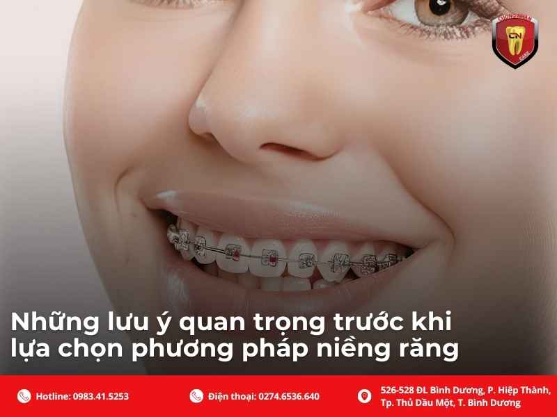 Những lưu ý quan trọng trước khi lựa chọn phương pháp niềng răng