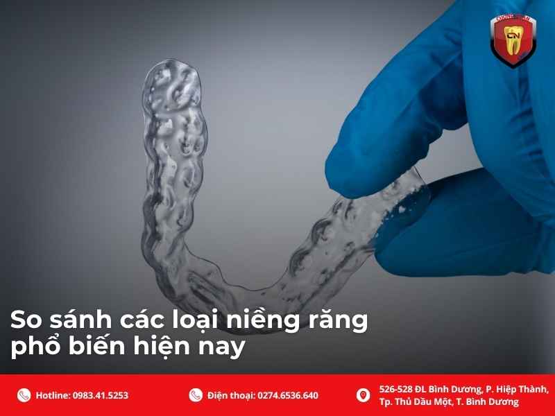 So sánh các loại niềng răng phổ biến hiện nay