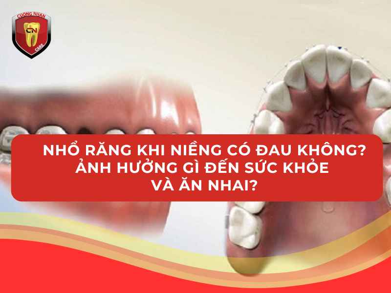 Việc nhổ răng có thể đau nhưng không ảnh hưởng đến chức năng nhai