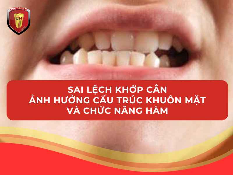 Niềng răng tại nhà không đúng cách làm sai lệch khớp cắn