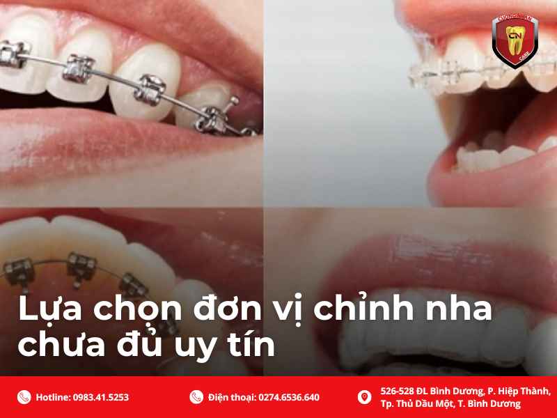 Lựa chọn đơn vị chỉnh nha chưa đủ uy tín