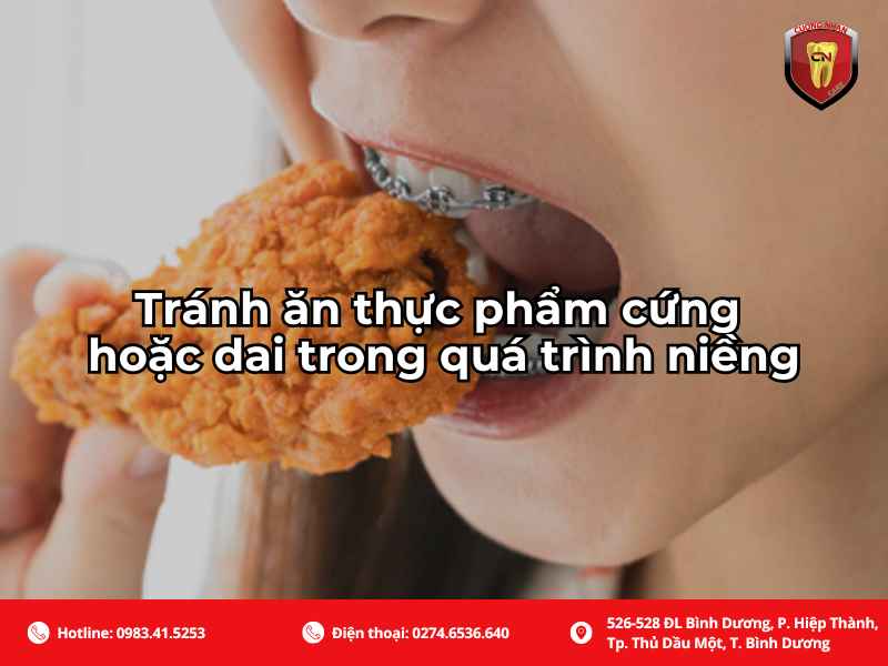 Tránh ăn thực phẩm cứng hoặc dai trong quá trình niềng