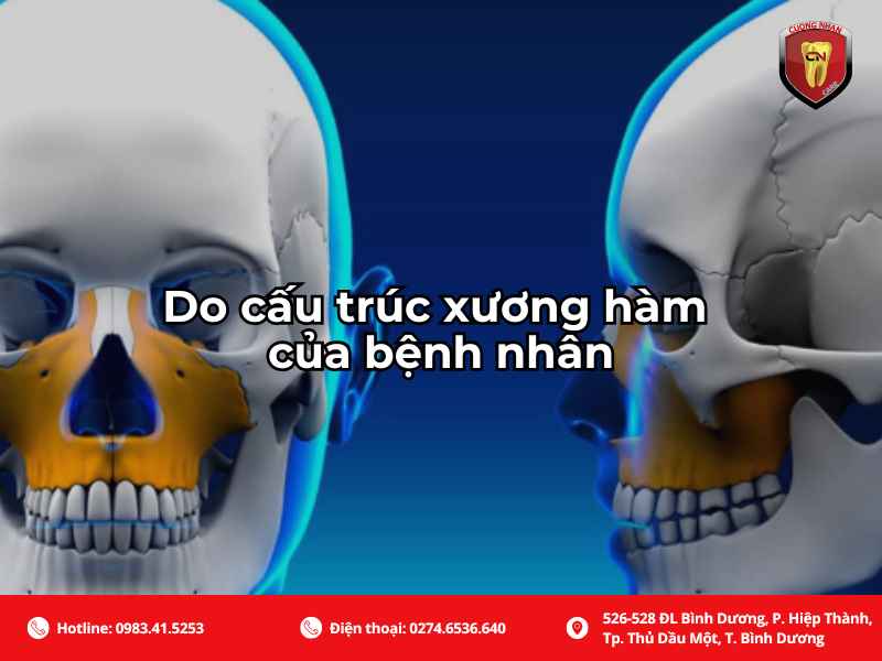 Do cấu trúc xương hàm của bệnh nhân