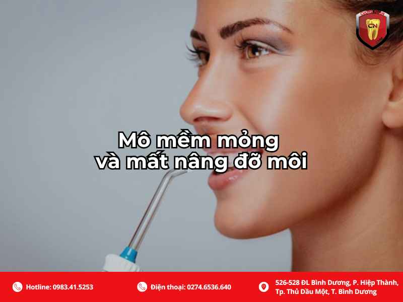 Mô mềm mỏng và mất nâng đỡ môi