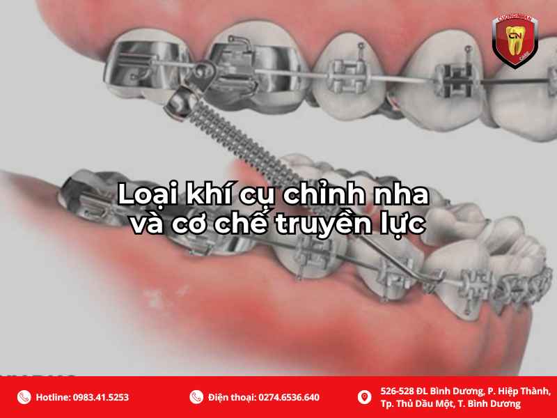 Tùy vào từng loại chỉnh nha mà có mức độ đau khác nhau