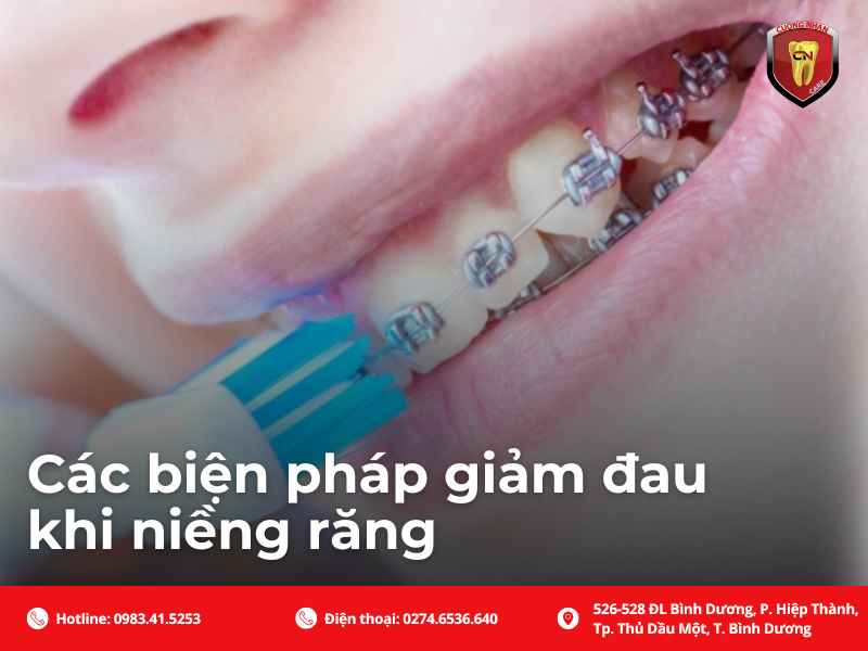Tổng hợp các biện pháp giúp giảm đau khi niềng răng