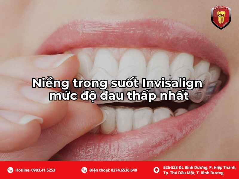 Niềng răng trong suốt Invisaligh