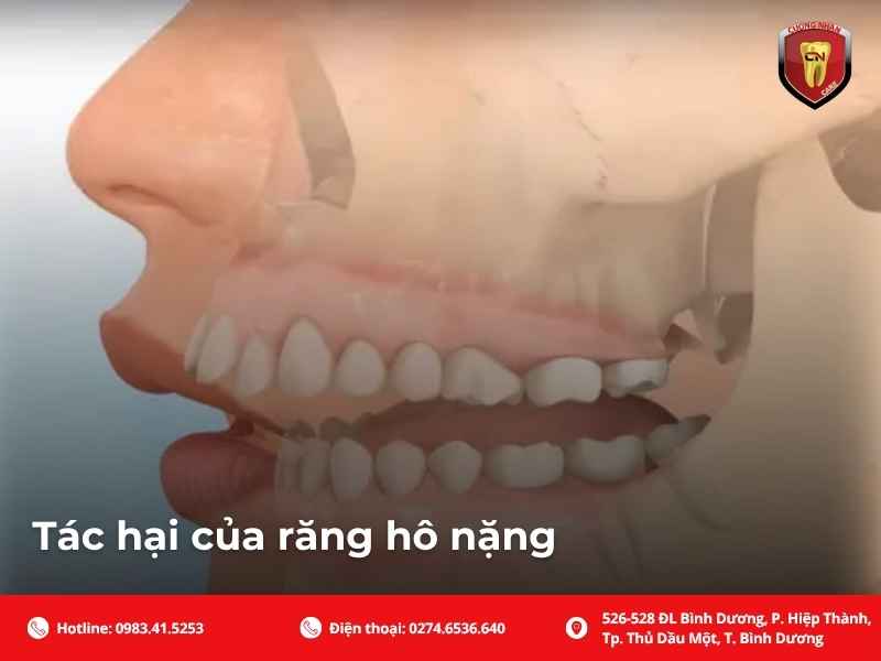 Yếu tố di truyền