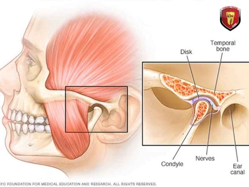 Tăng nguy cơ mắc các bệnh răng miệng