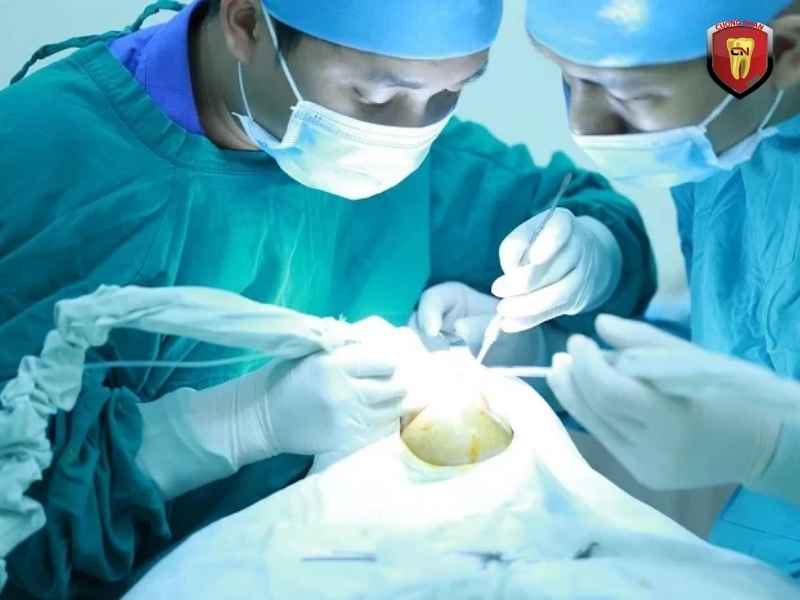 Phẫu thuật chỉnh hàm