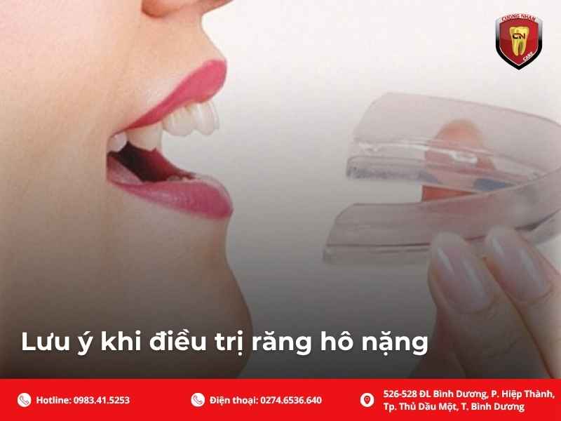 Lưu ý khi điều trị răng hô nặng