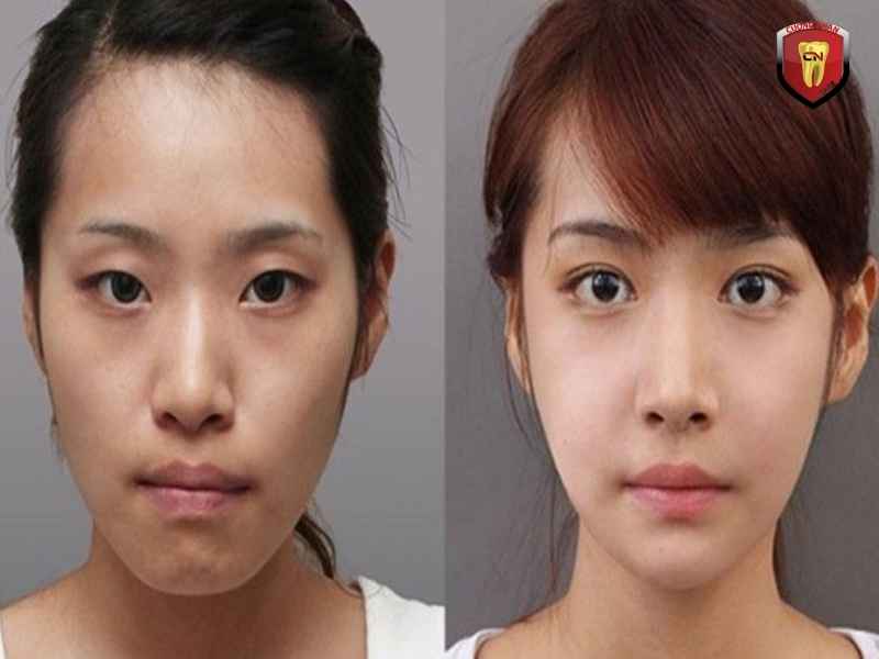 Gương mặt mất cân đối