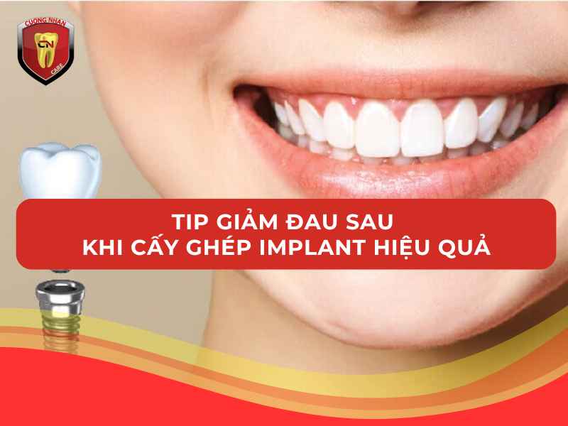 Tip giảm đau sau khi cấy ghép Implant hiệu quả