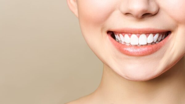 Các khuyết điểm hay gặp với 2 răng cửa