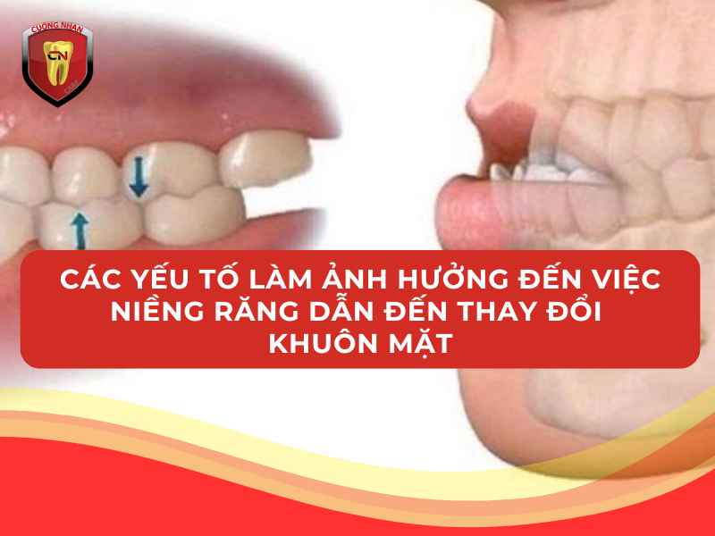 Các yếu tố làm ảnh hưởng đến việc niềng răng dẫn đến thay đổi khuôn mặt