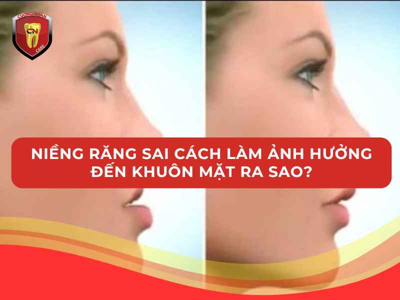 Việc không kiểm soát được lực sẽ dẫn tới niềng sai cách và làm ảnh hưởng đến khuôn mặt
