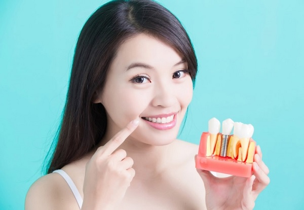 Quá trình tích hợp của trồng răng implant Hàn Quốc có tốt không