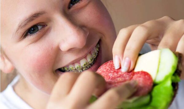 Niềng răng ảnh hưởng đến quá trình ăn uống 