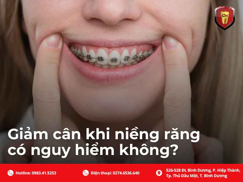 Giảm cân khi niềng răng có ảnh hưởng đến sức khỏe ?