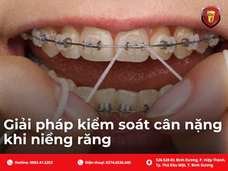 Một số giải pháp giúp kiểm soát cân nặng khi niềng răng