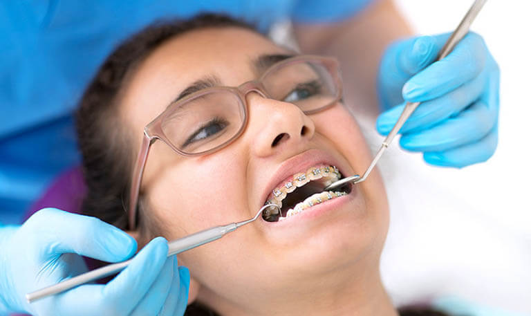 Các nguyên nhân thưc sự khiến răng bị yếu đi