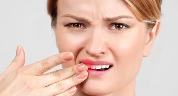 Răng lung lay khi niềng do đâu? Có nguy hiểm không ?