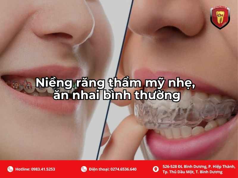 Đối với trường hợp niềng răng thẩm mỹ