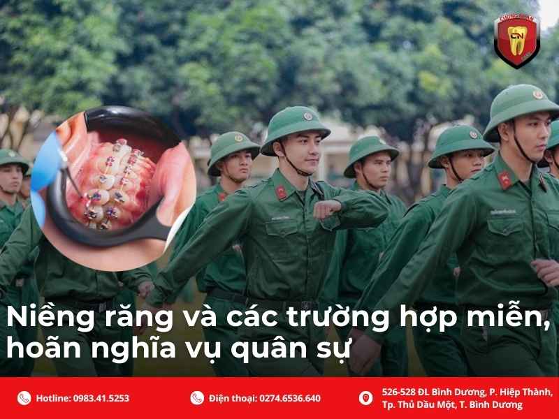 Niềng răng và các trường hợp miễn, hoãn nghĩa vụ quân sự