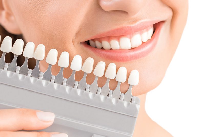 Làm sao để tăng độ bền răng sứ?