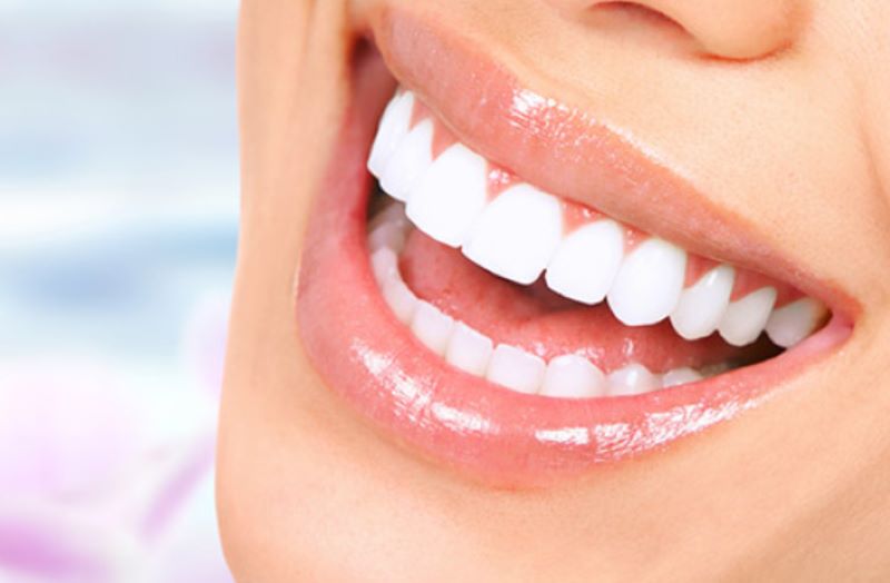 Bọc răng sứ thẩm mỹ giúp cải thiện màu răng trắng sáng hơn 