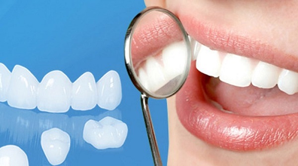 Cảm giác sau khi bọc răng sứ thường gặp gì?