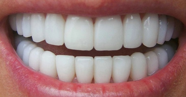 Chăm sóc răng miệng như thế nào sau khi bọc răng sứ