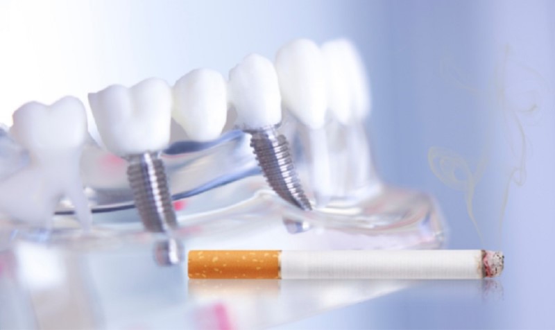 Trồng răng implant có hút thuốc được không?