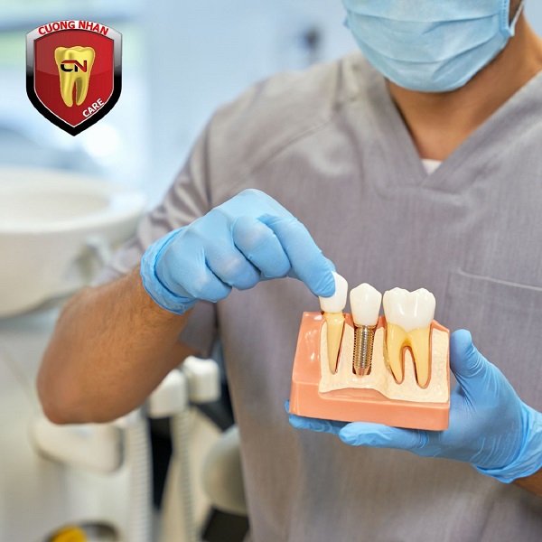 Nguyên nhân nào làm cho việc trồng răng Implant bị lung lay
