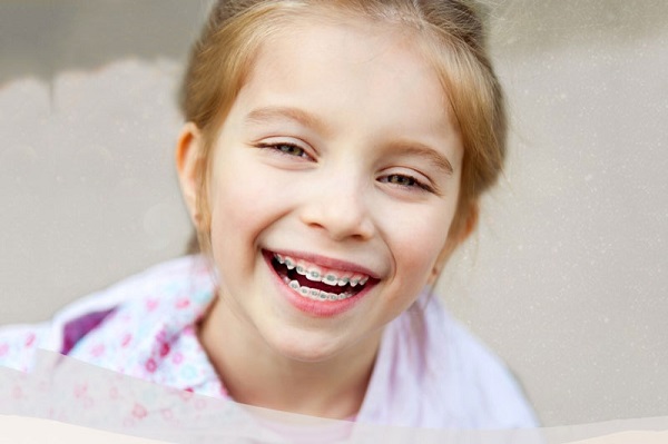 Giai đoạn niềng răng tốt nhất là từ 6 đến 12 tuổi 
