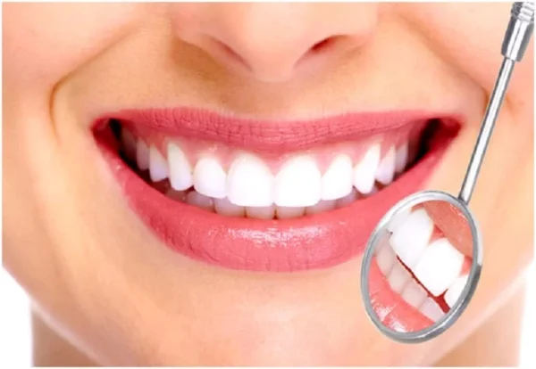 Những trường hợp răng sứ bị hỏng thường gặp
